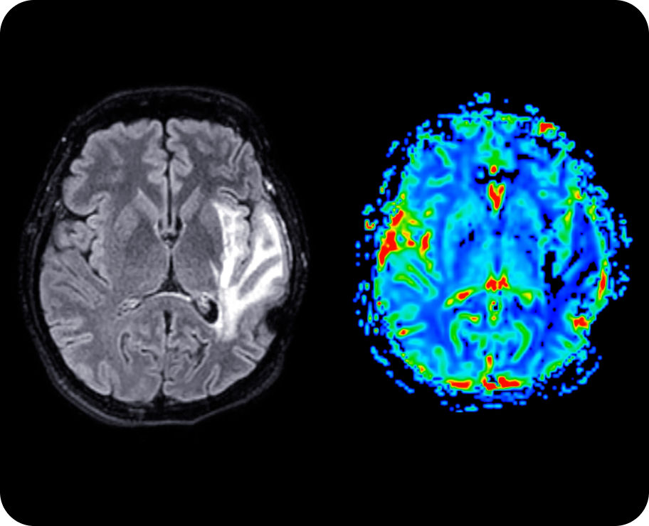 CNS