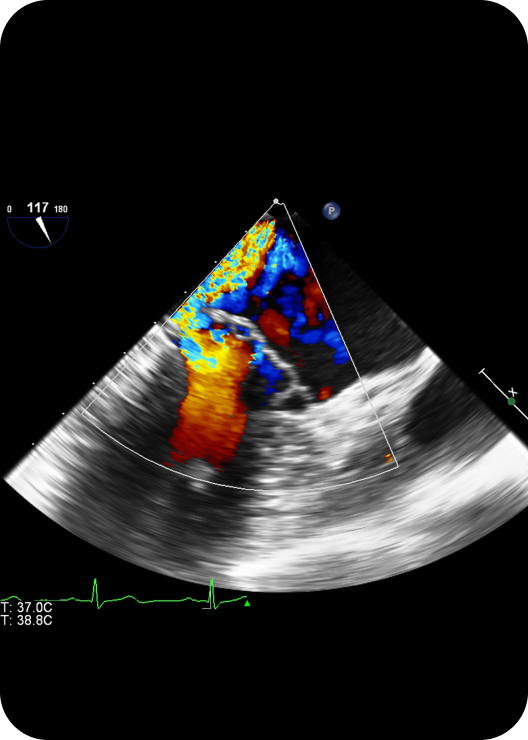 Cardiovascular