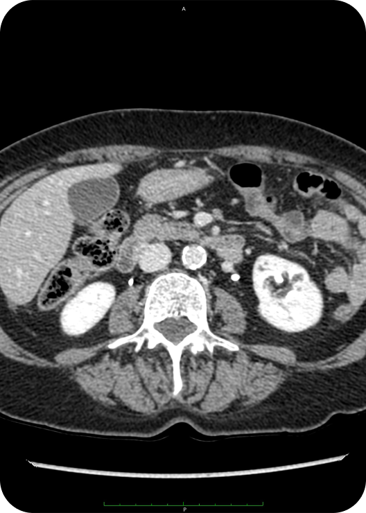 Gastrointestinal