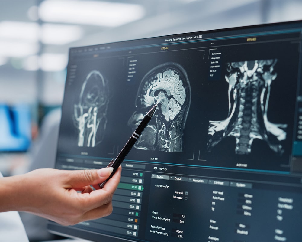 Person pointing at musculoskeletal image scan on computer screen with a ballpoint pen