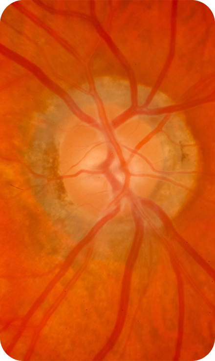Ophthalmology