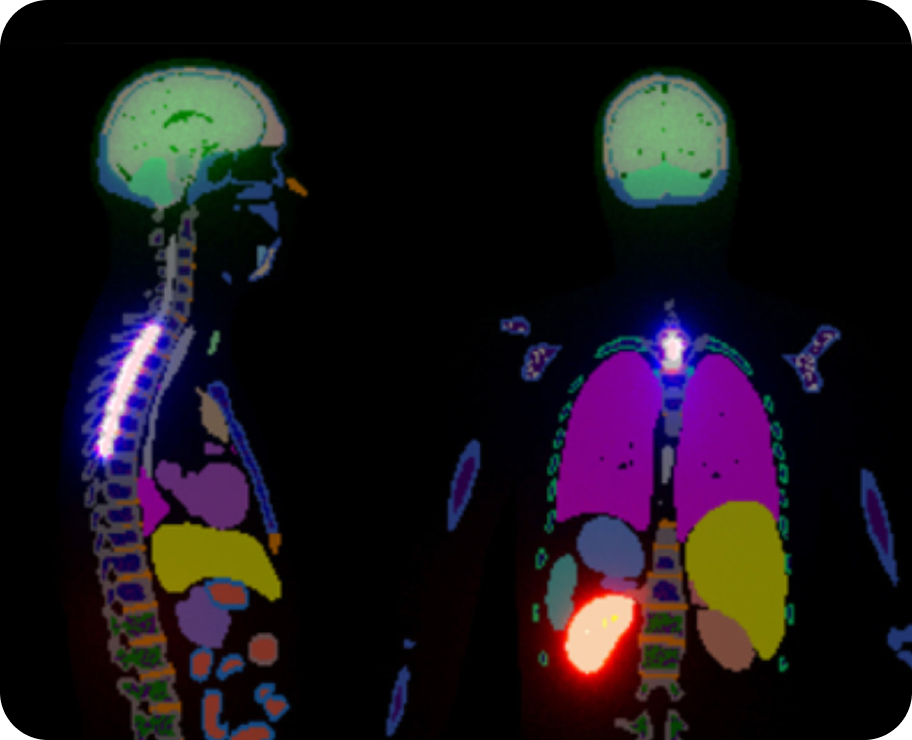 Radiopharmaceuticals