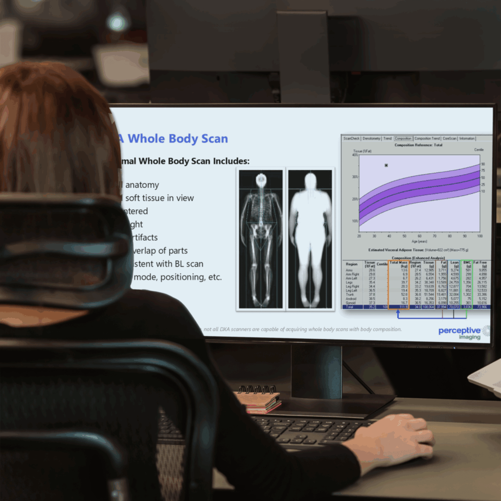 Person seated at desk viewing whole body scan results on large monitor, including X-ray images, body composition graph, and data table.