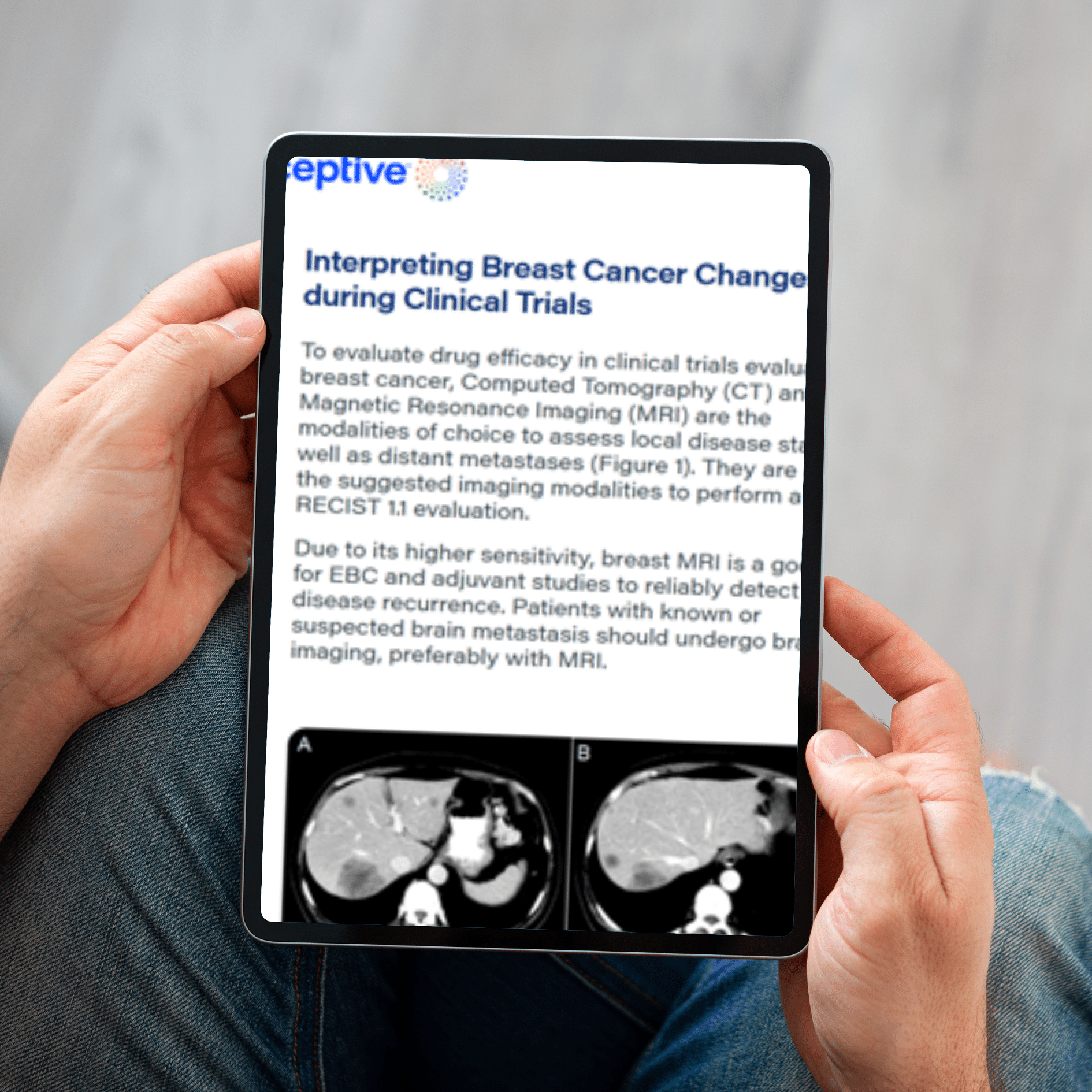 Imaging in Metastatic Breast Cancer Clinical Trials: Overcoming Specific Challenges
