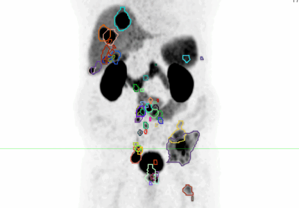 image 31 cropped 431x300
