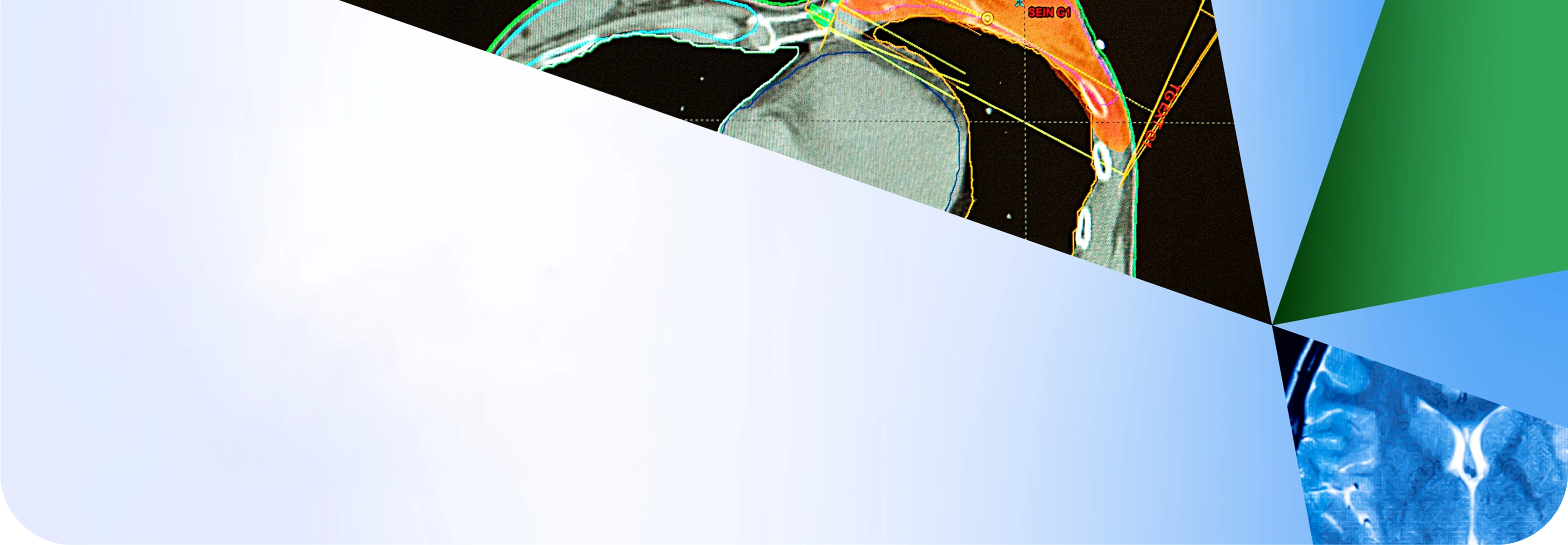 A medical imaging room scene with a CT or MRI scanner visible in the background, partially obscured by geometric overlapping shapes in light blue, white, green, and blue tones; also showing a patient lying inside the scanner and medical monitors nearby.