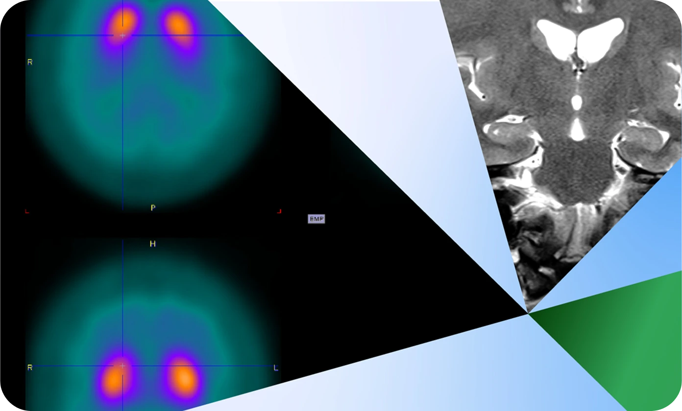 Neuroscience CRO with Early Phase Continuity
