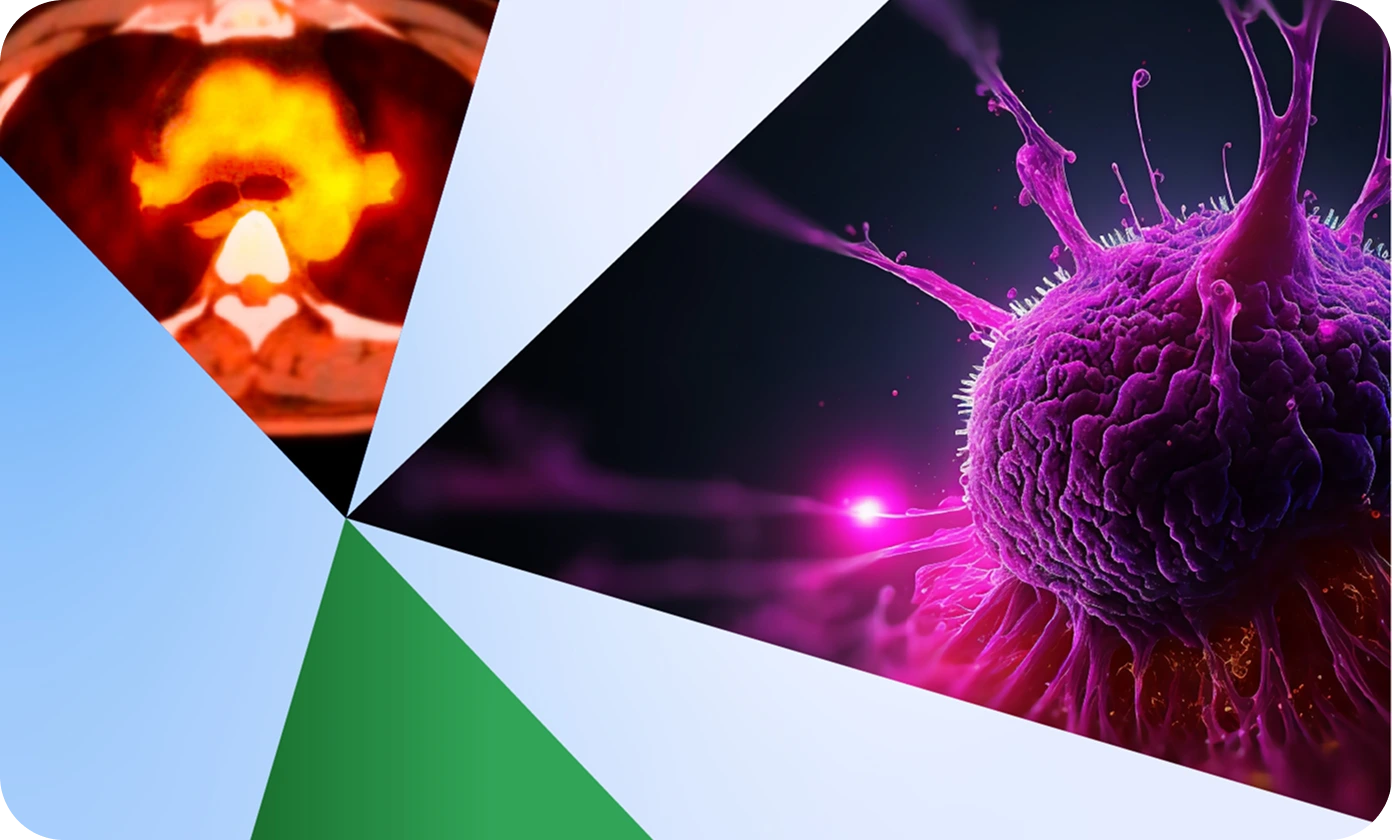 Abstract collage featuring medical imagery. On the left, a scan of the human chest with highlighted internal areas in bright orange and red. On the right, a close-up 3D rendering of a cancer cell in vivid purple with spiky extensions. Geometric shapes in white, blue, and green divide the image sections.