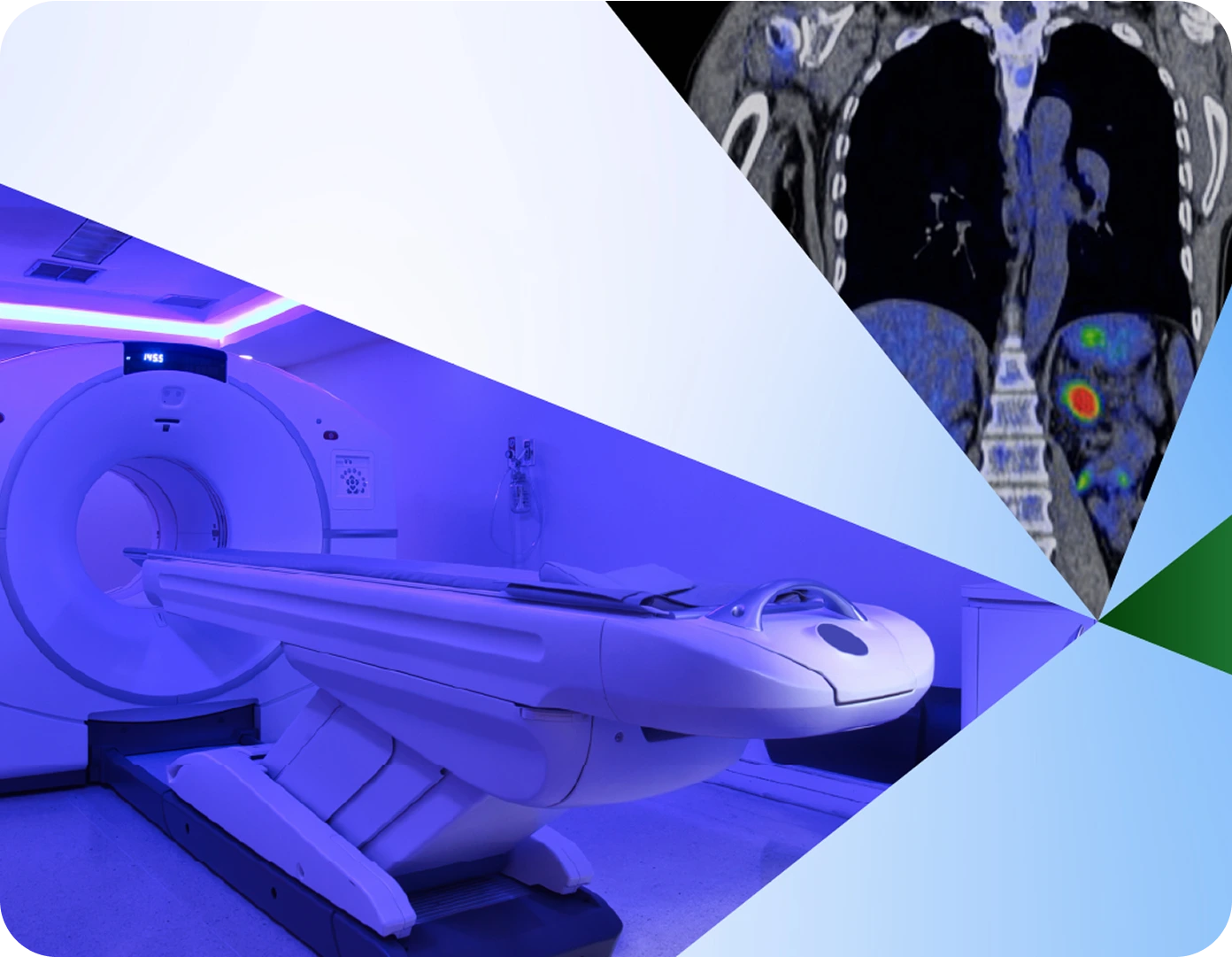 Abstract collage showing medical imaging technology. On the left, a brightly lit MRI or CT scanner with a futuristic design glows in blue light. On the right, black-and-white diagnostic scans of the human torso with highlighted areas in color. Geometric white, blue, and green shapes separate the sections.