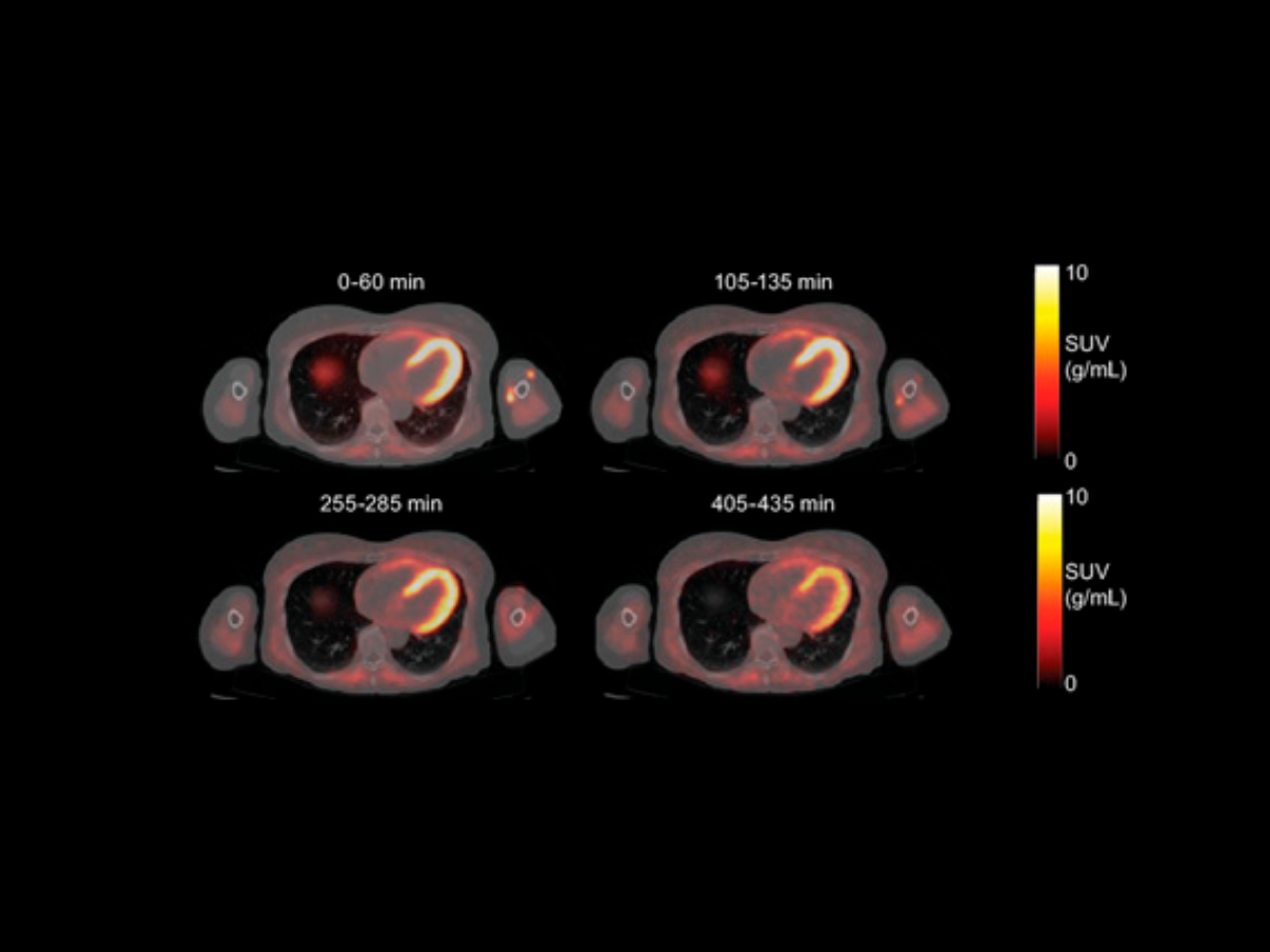 Evaluation of Mitochondrial Complex 1 Density with [¹⁸F]BCPP-EF in a Murine Model and Individuals with Friedreich Ataxia