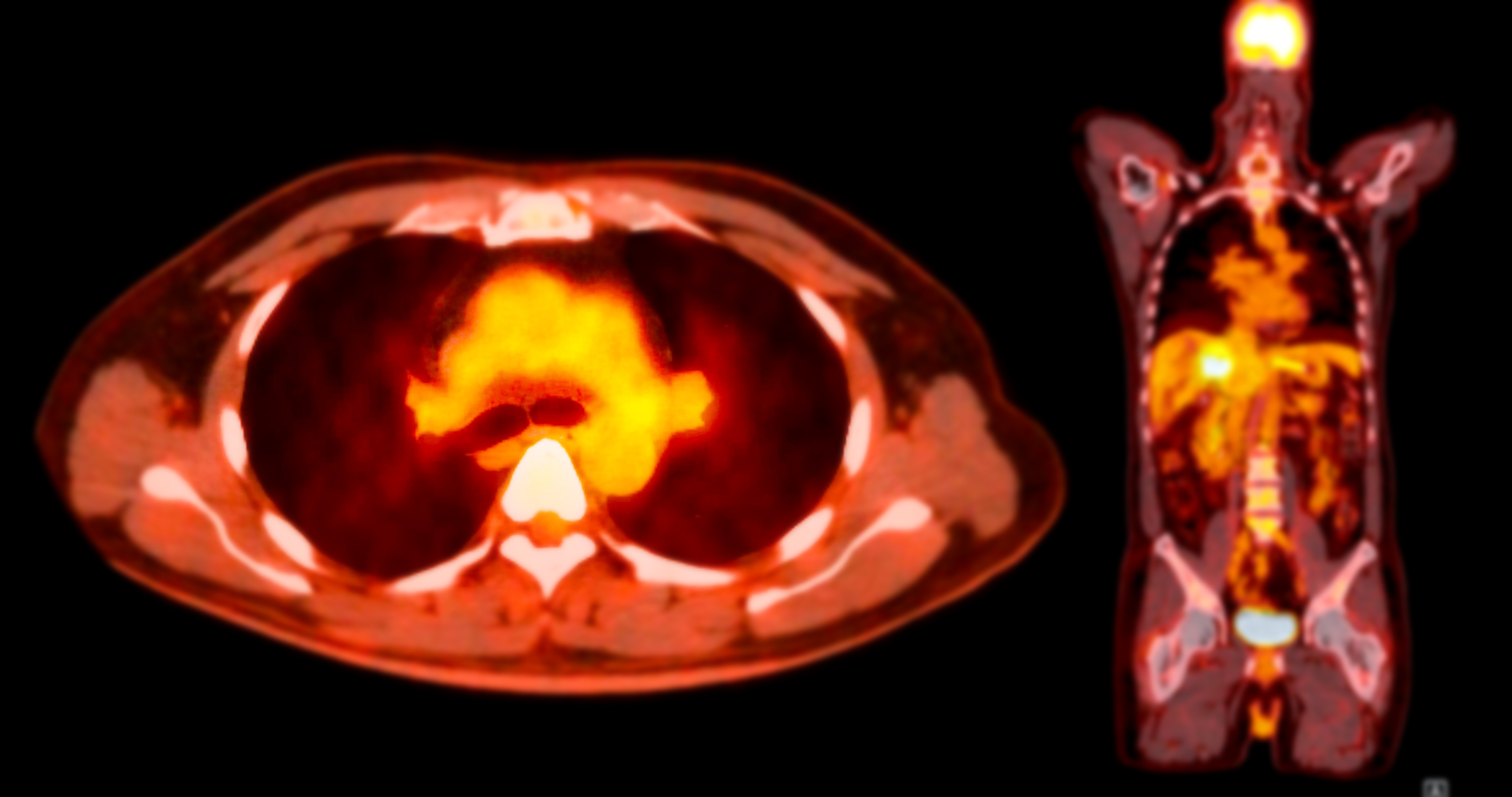 Imaging Excellence in Hematology Trials: From Protocol through Delivery