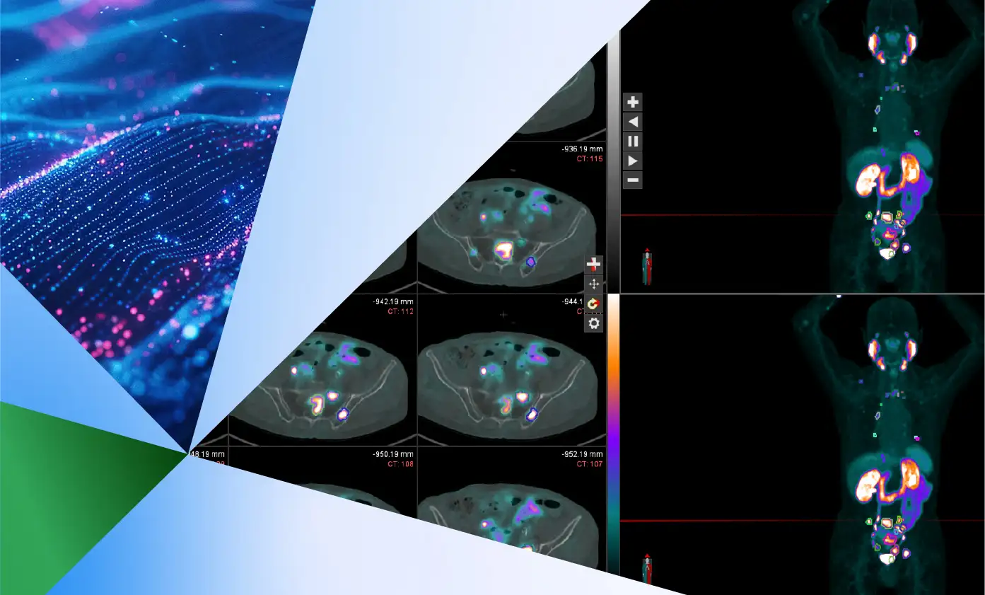 A collage featuring colored scan images, including multiple PET/CT body scans highlighting metabolic activity and cross-sectional abdominal images on a black background, overlaid with angular geometric shapes in blue, green, and white, and a digital abstract pattern in the upper left corner.