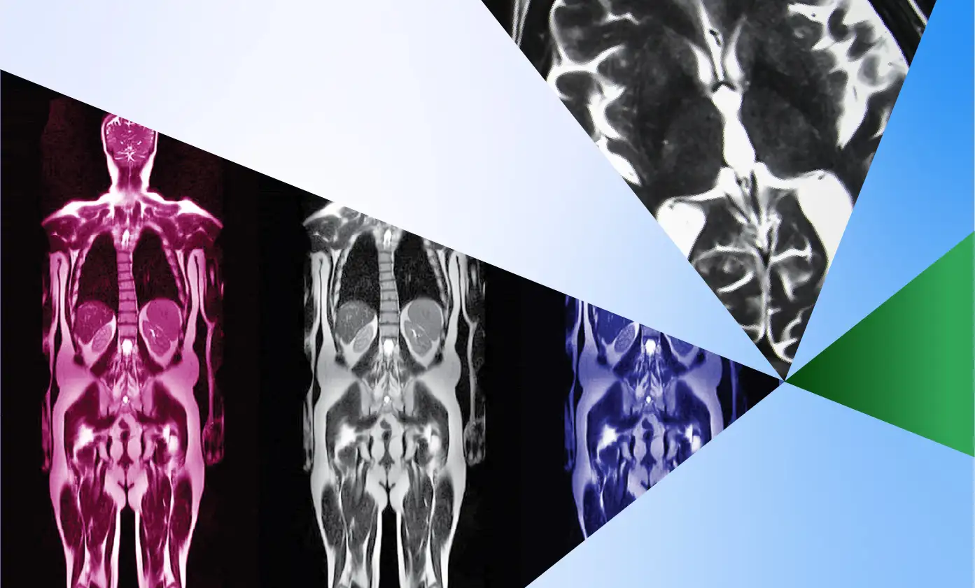 Multiple full-body MRI scans are shown side by side in different color tones (pink, white, blue), partially overlaid by angular geometric shapes in various shades of blue, green, and white, with a close-up of a brain scan in the upper right section.