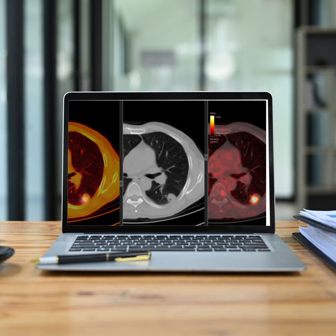 Early Phase Oncology Clinical Trials: Imaging Insights from Industry Experts